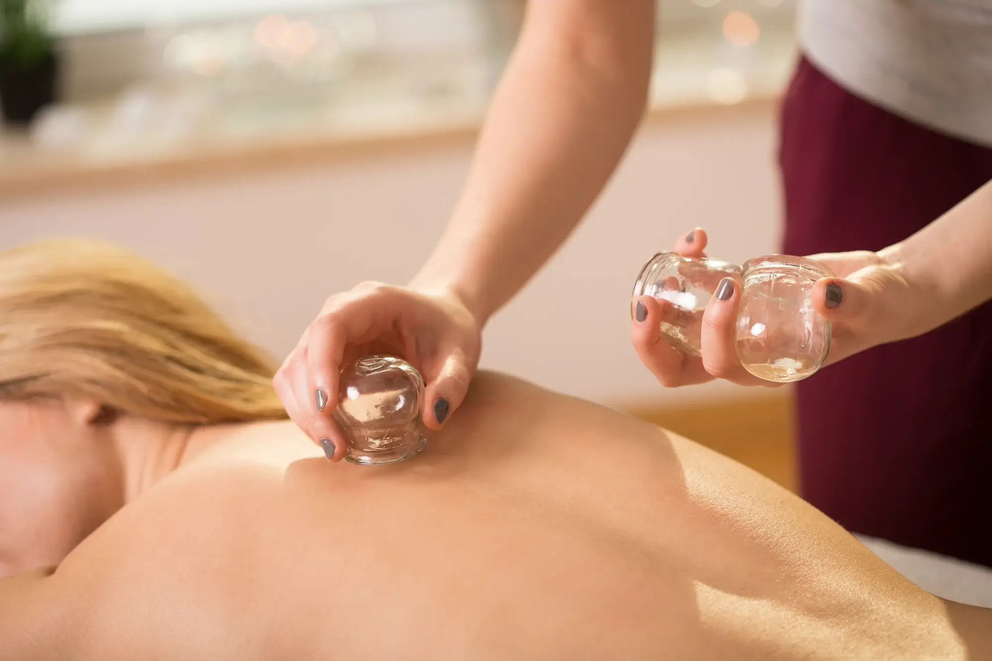 Cupping Massage Therapy